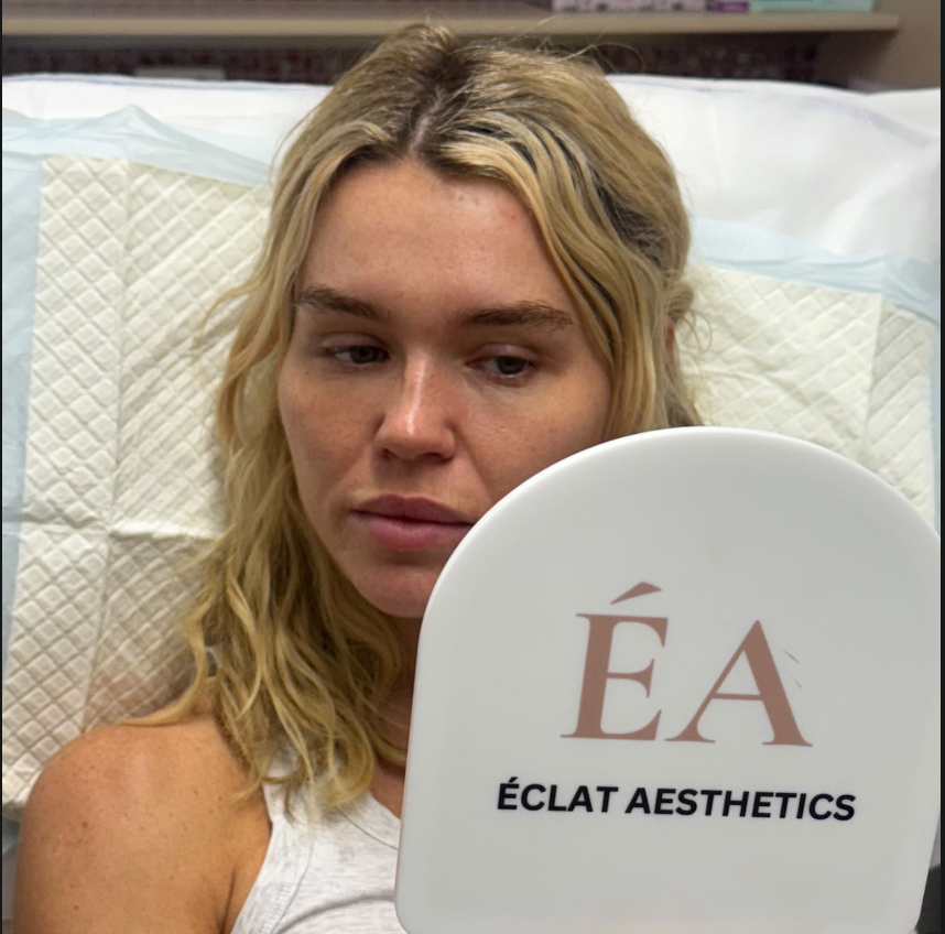 Anti-Wrinkle Treatment at Éclat Aesthetics
